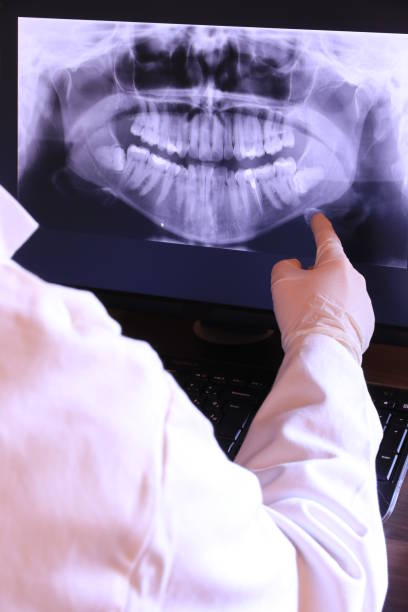 Best Emergency Root Canal Treatment in Bunker Hill, OR